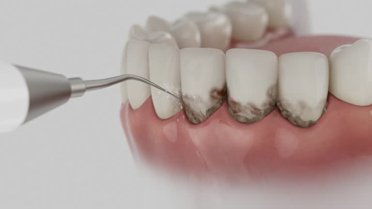 Trusted Teeth Cleaning And Checkup service in Socorro, NM - Dentist Open Now